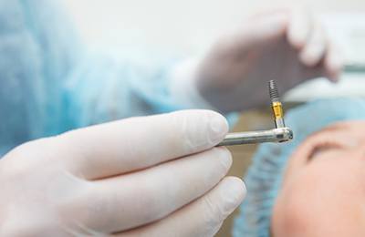 dentist holding implant post during surgery 