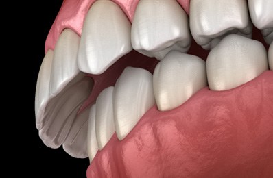 smiling dental patient with dentist in the background 