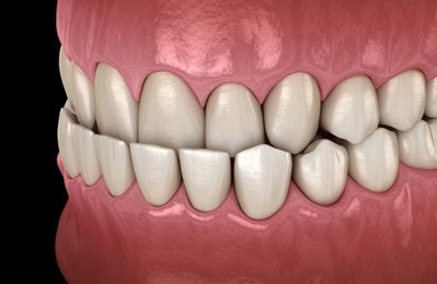 smiling dental patient with dentist in the background 