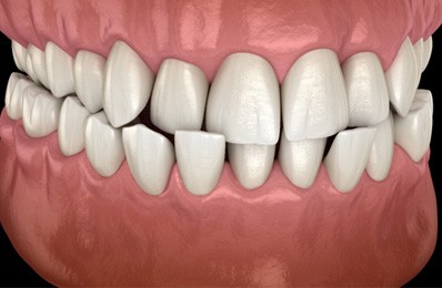 smiling dental patient with dentist in the background 