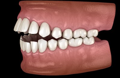 smiling dental patient with dentist in the background 
