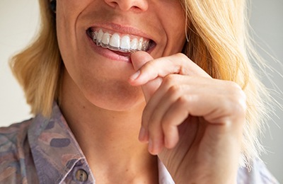 woman rinsing Invisalign tray 