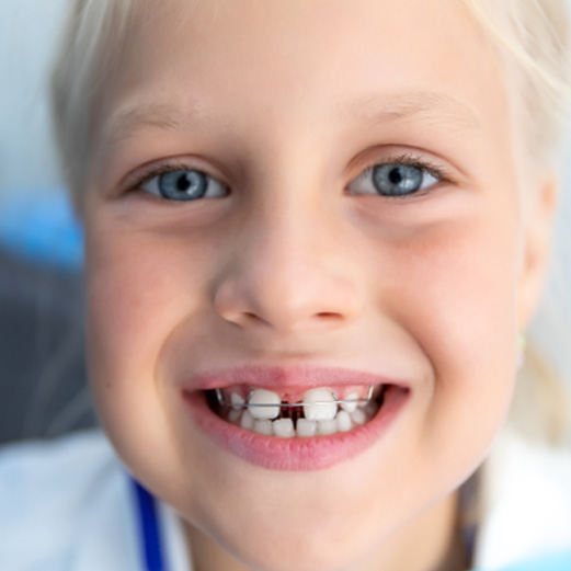 Young girl smiling with removable retainer 