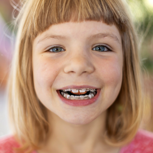 Young girl smiling with retainer