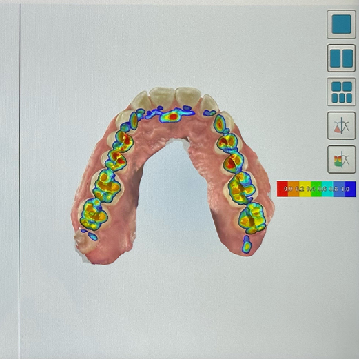 Digital scans of a row of teeth