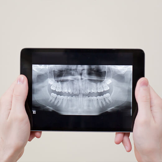 Person holding tablet with digital dental x rays of teeth