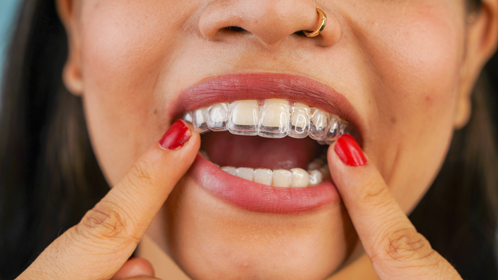 woman putting on Invisalign tray