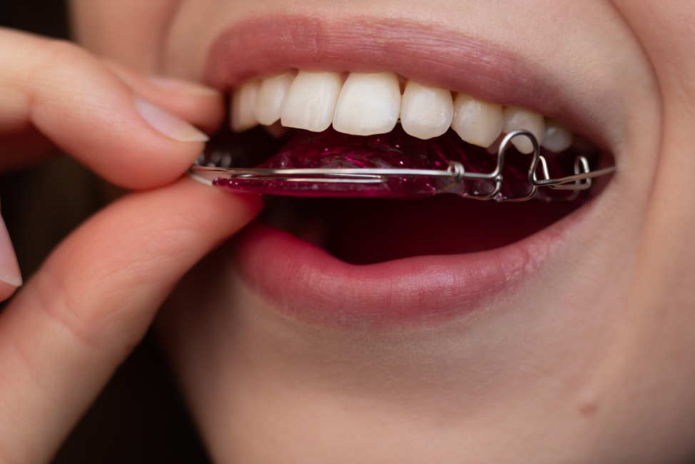 closeup of woman putting on retainer